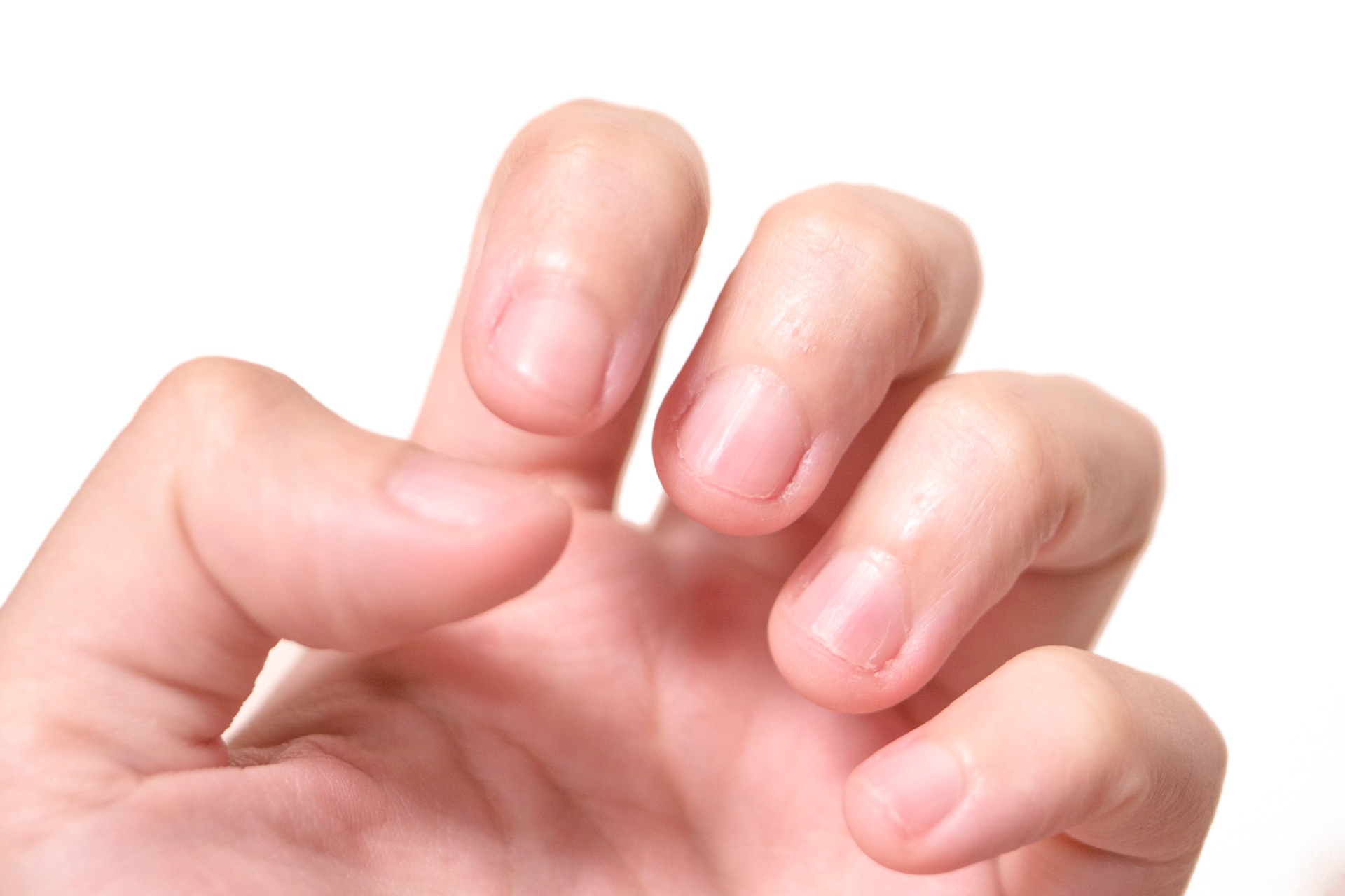 深爪のお悩みに対応 | 大分のネイルならLink Nail